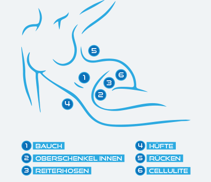 KRYOKONTUR baut stärende Fettdepots ab! KRYOKONTUR baut stärende Fettdepots ab!